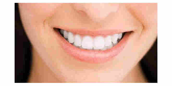 Evde Diş Beyazlatma Nasıl Yapılır?